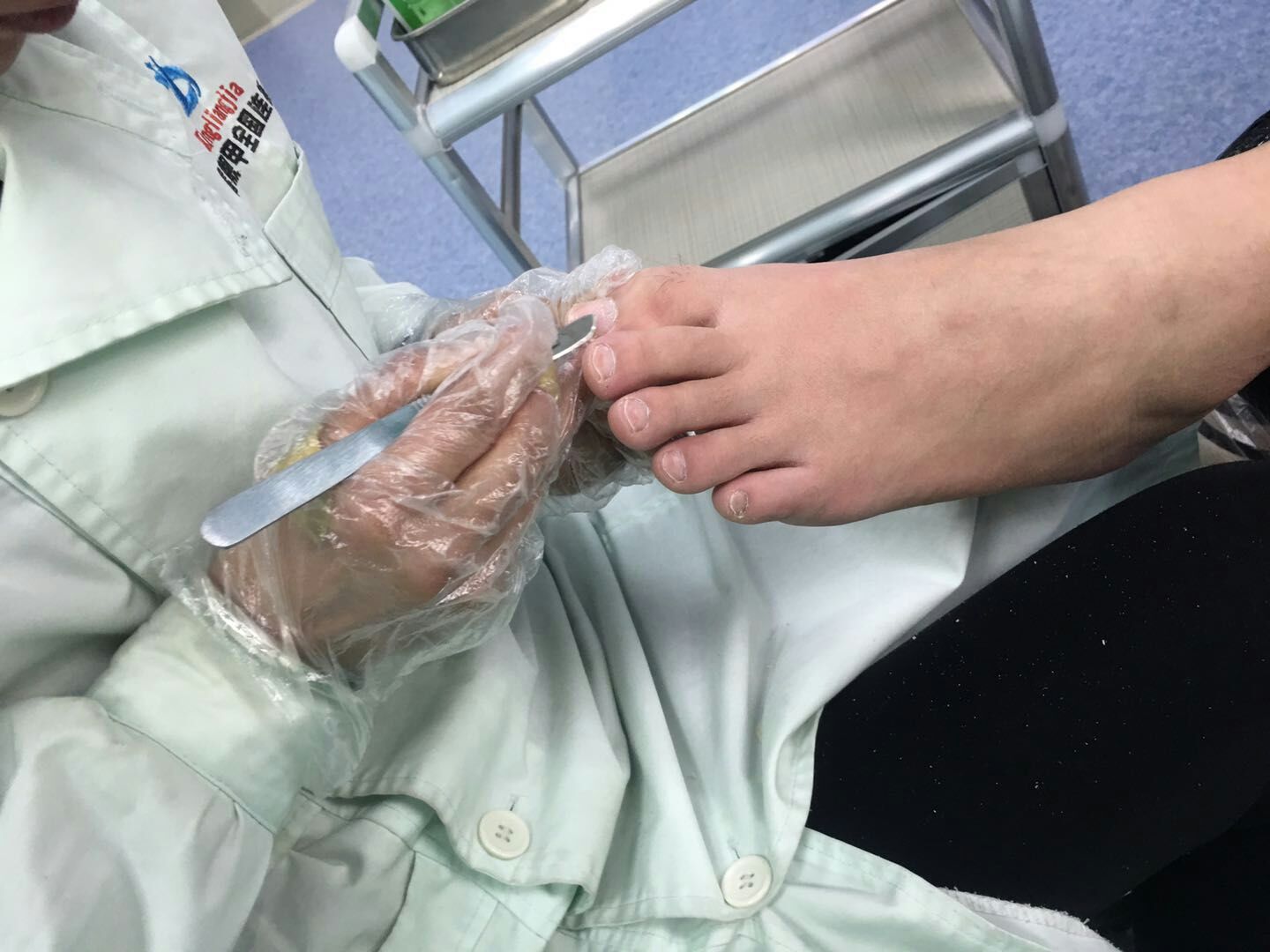 哪个灰指甲项目品牌优势比较好